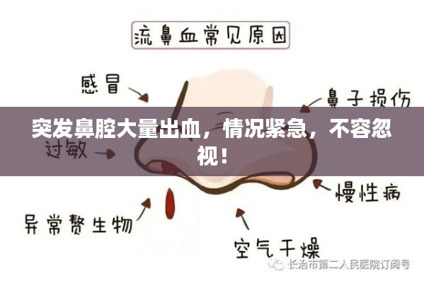 突发鼻腔大量出血,情况紧急,不容忽视!